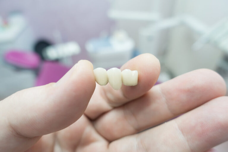 dental ceramic metal bridges in the hands of a doctor