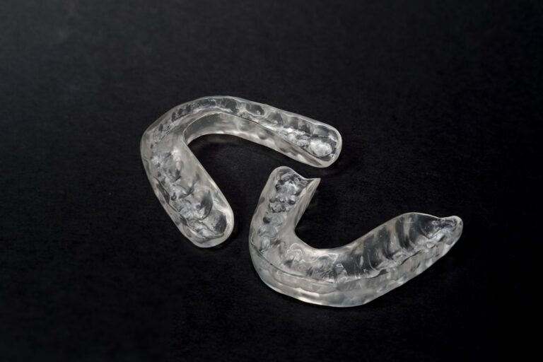 Custom nightguard dental splint used to treat teeth grinding and bruxism
